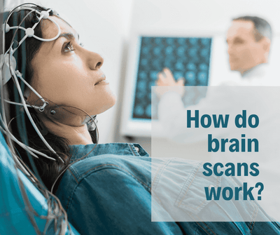 How do brain scans work?